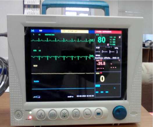 Монитор пациента сторм. Монитор прикроватный Сторм 5900 Dixion ,. Сторм 5600 монитор. Монитор пациента Сторм 5800. Монитор пациента Сторм 5500 Диксион.