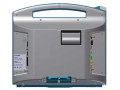 Мониторы анестезиологические и реаниматологические для контроля ряда физиологических параметров МАР-02-КАРДЕКС (Фото 2)