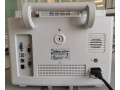 Мониторы пациента Vista 120S (Фото 2)
